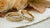 Do You Need Both Engagement And Wedding Rings