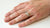 Why Am I Suddenly Allergic To My Wedding Ring